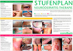 Poster Stufenplan Neurodermitis-Therapie